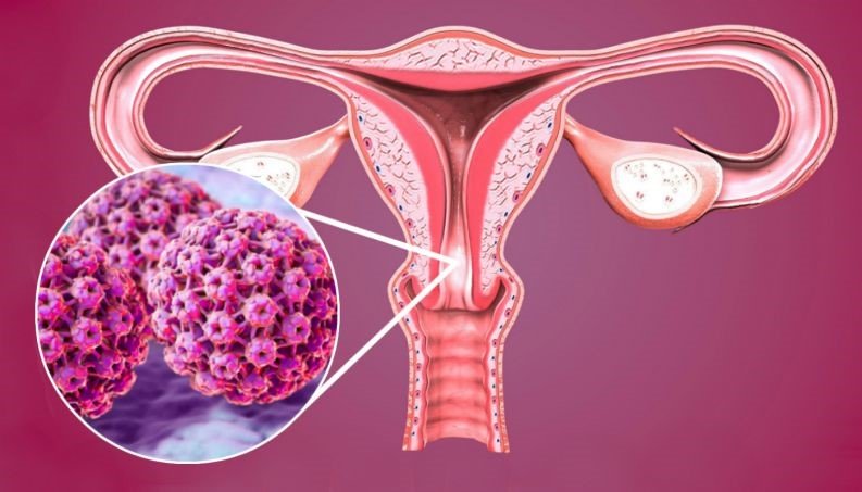Tiêm vaccine HPV: Lịch tiêm và thời điểm vàng bảo vệ